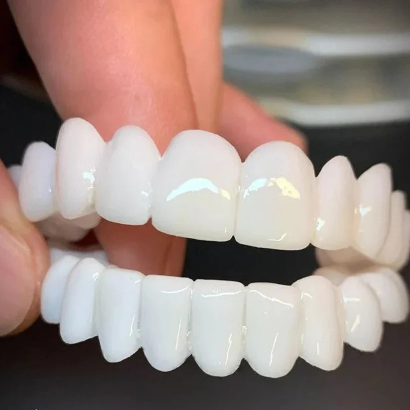 Dental Prosthetic Teeth – Achieve Instant Confidence and a Flawless Smile-Denture-Unique Casa-Unique Casa
